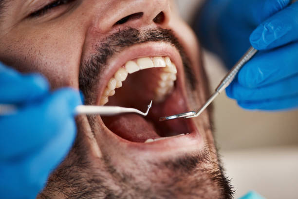 Best Emergency Wisdom Teeth Removal in Bradford Woods, PA